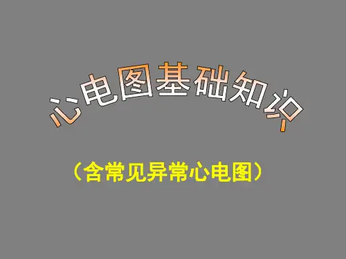 心电图基础知识 含常见异常心电图