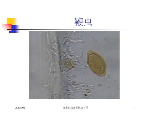 寄生虫虫卵显微镜下图课件