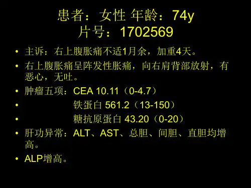 胆囊癌病案PPT课件