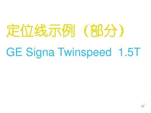 GE_1.5T磁共振操作的指南_定位线示例(神经系统)