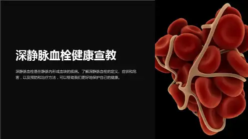 深静脉血栓健康宣教