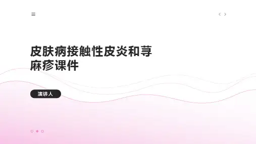 皮肤病接触性皮炎和荨麻疹课件