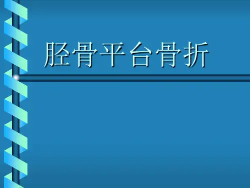 胫骨平台骨折