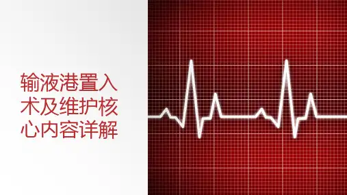 输液港置入术及维护核心内容详解
