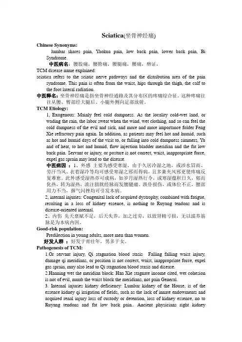 坐骨神经痛