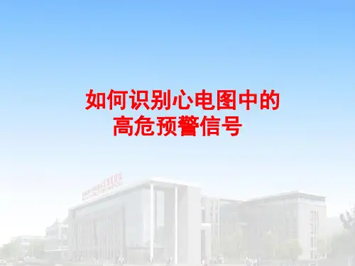 心电图预警高危信号