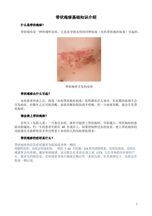 带状疱疹基础知识介绍