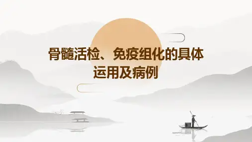 骨髓活检、免疫组化的具体运用及病例
