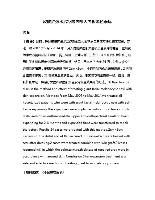 皮肤扩张术治疗颜面部大面积黑色素痣