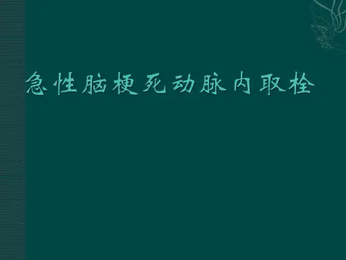 动脉取栓ppt课件