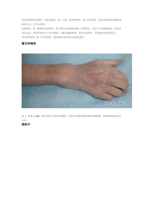 23个骨科常见体征 你都认识吗