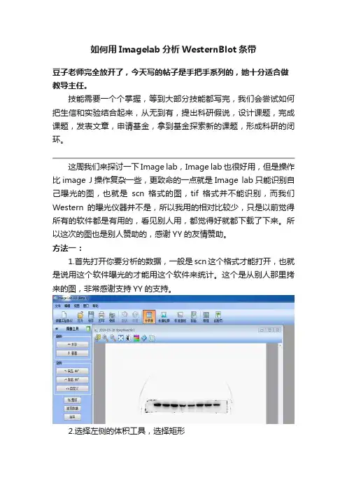 如何用Imagelab分析WesternBlot条带