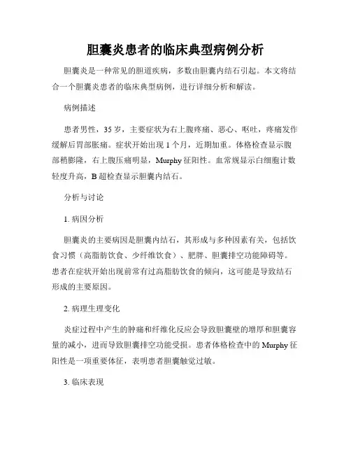 胆囊炎患者的临床典型病例分析