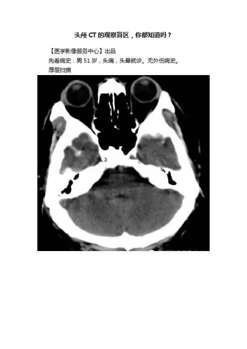 头颅CT的观察盲区，你都知道吗？