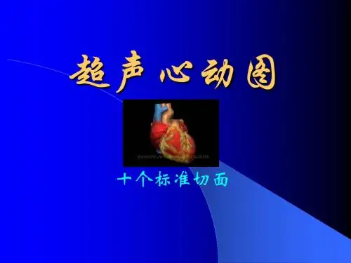 超声心动图常用切面