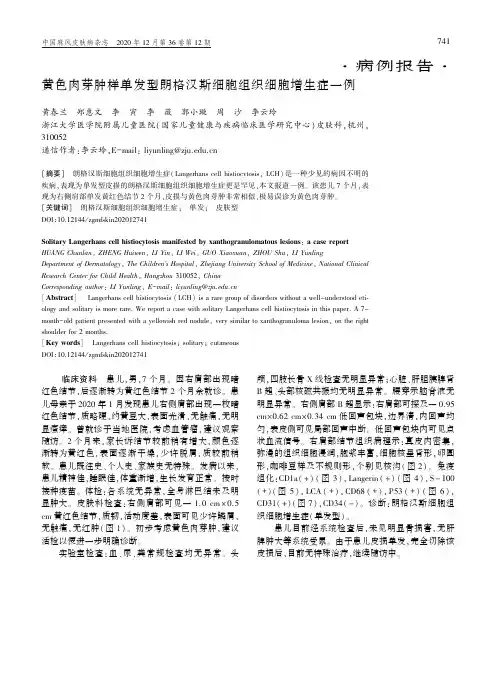 黄色肉芽肿样单发型朗格汉斯细胞组织细胞增生症一例