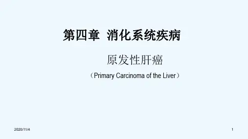 原发性肝癌消化系统疾病内科学