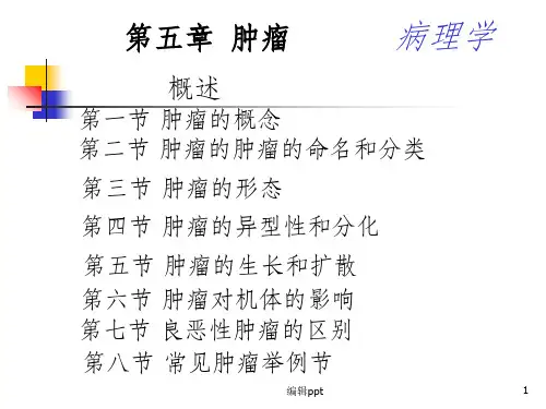 肿瘤ppt课件
