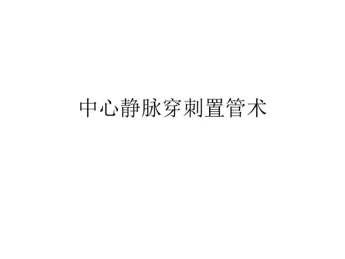 中心静脉穿刺置管术