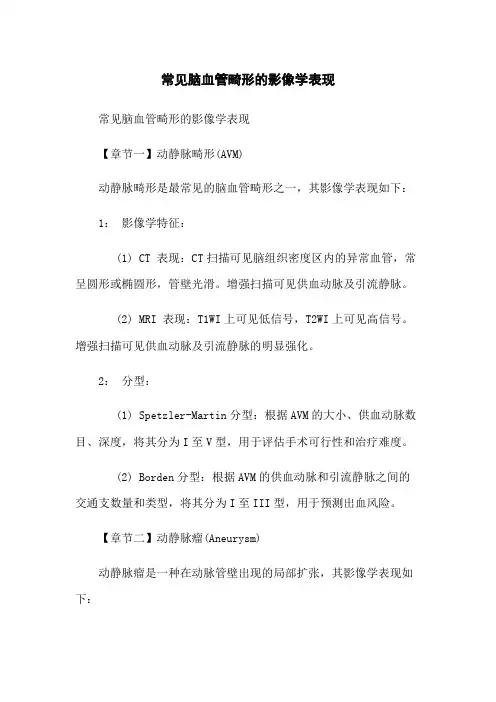 常见脑血管畸形的影像学表现