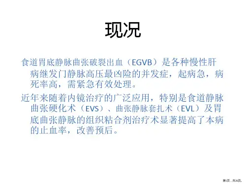 食道胃底静脉曲张破裂出血ppt课件