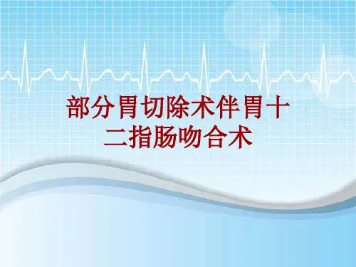 手术讲解模板：部分胃切除术伴胃十二指肠吻合术