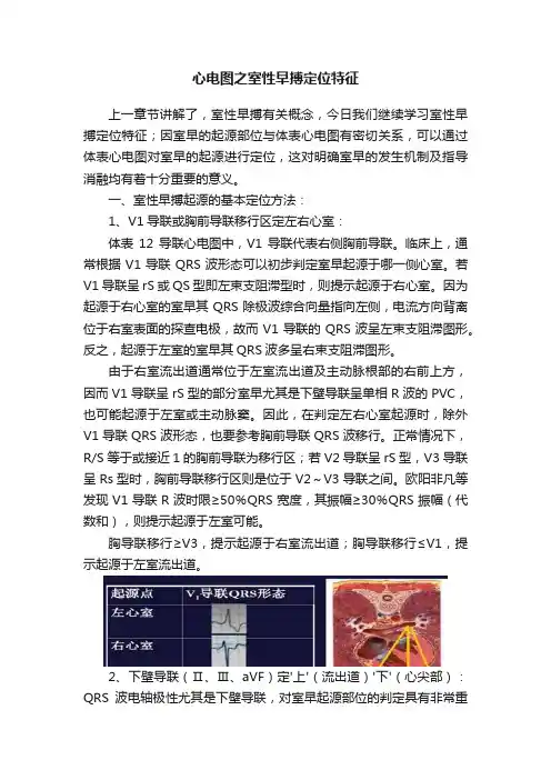心电图之室性早搏定位特征