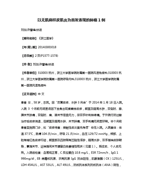 以无肌病样皮肌炎为首发表现的肺癌1例