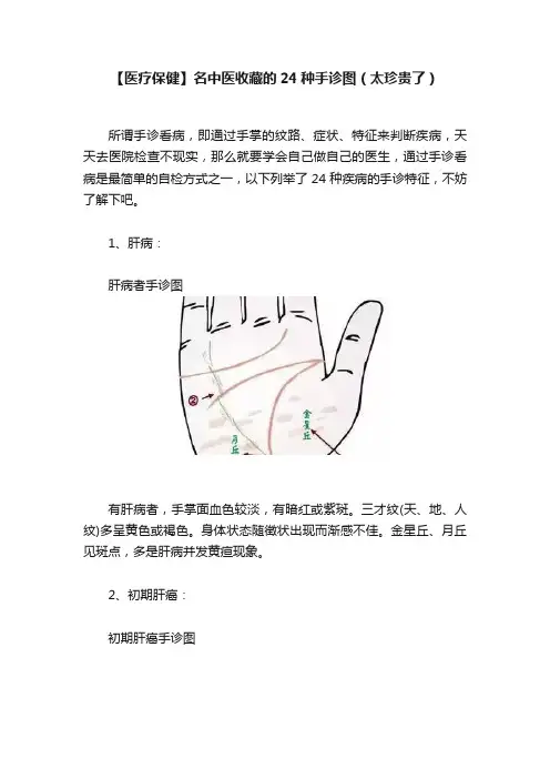 【医疗保健】名中医收藏的24种手诊图（太珍贵了）