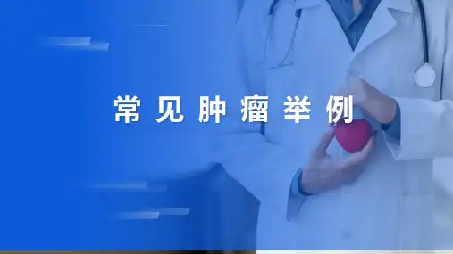 肿瘤 常见肿瘤举例 病理学课件