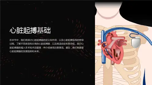 心脏起搏基础