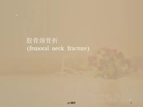 股骨颈骨折--ppt课件