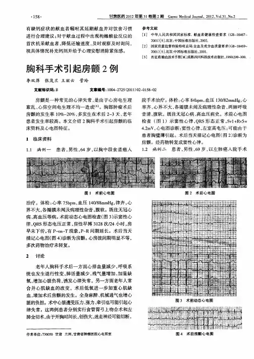 胸科手术引起房颤2例