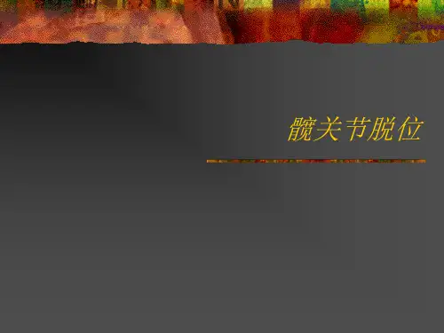 【精品PPT】髋关节脱位