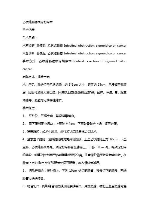 乙状结肠癌根治切除术