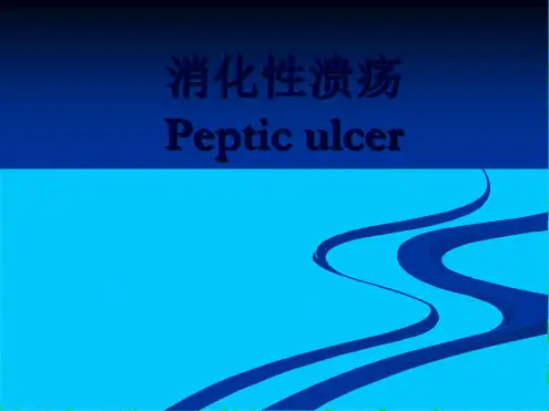 消化性溃疡(共72张PPT)