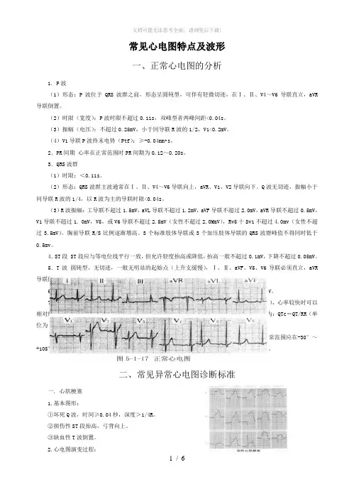 常见心电图特点及波形
