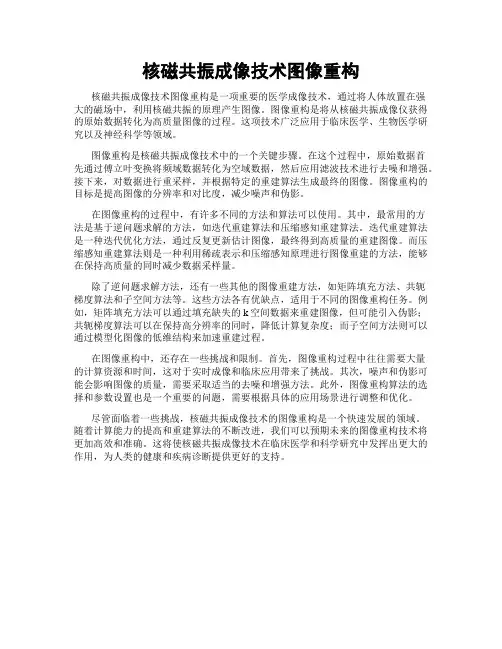 核磁共振成像技术图像重构