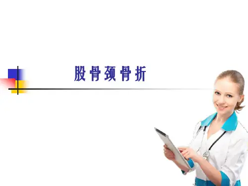 股骨颈骨折ppt课件