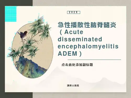 急性播散性脑脊髓炎