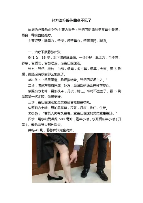 经方治疗静脉曲张不见了