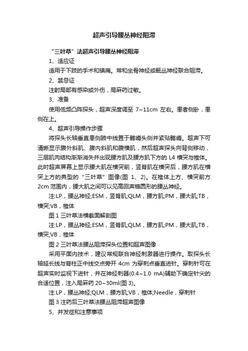 超声引导腰丛神经阻滞