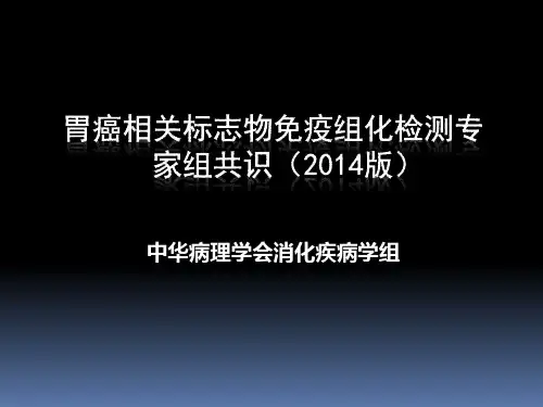 胃癌免疫组化共识
