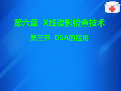 DSA造影检查(X线检查技术课件)