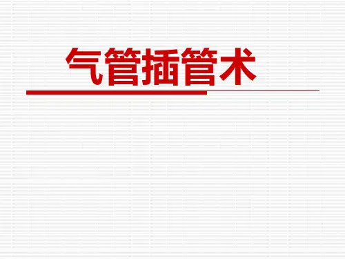 气管插管术