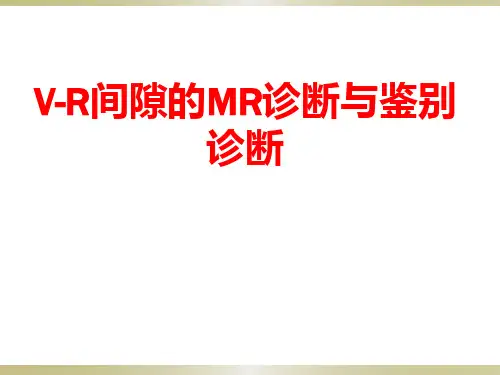 脑血管周围间隙(V-R间隙)的MRI诊断与鉴别诊断