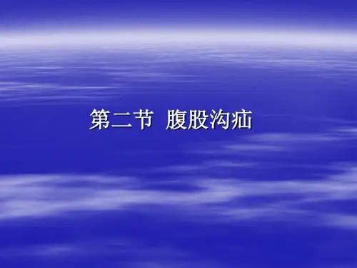 第二部分腹股沟疝