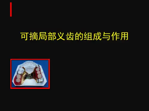 可摘局部义齿的组成与作用