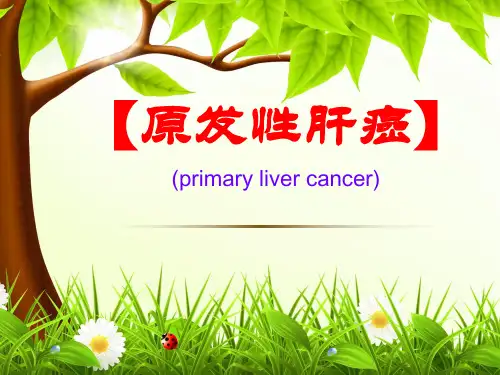 原发性肝癌