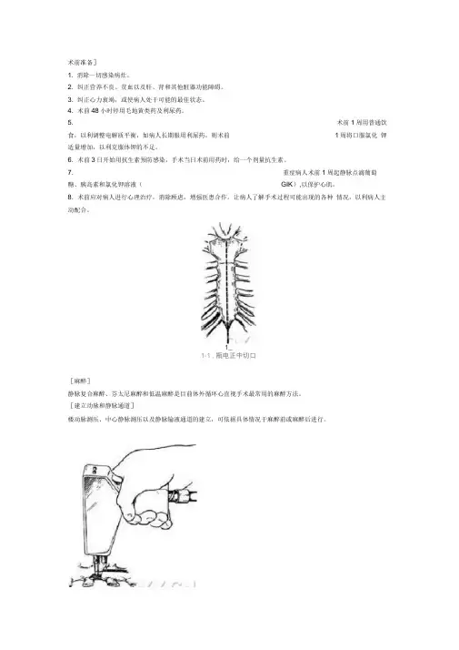 体外循环建立步骤
